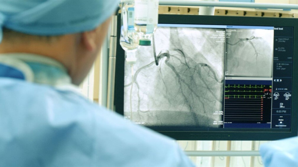 Брянщина с списке лучших по лечению сердечно-сосудистых заболеваний