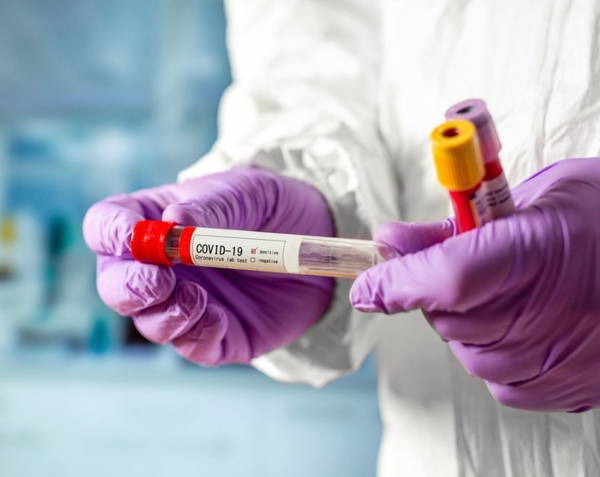 В Рогнединском районе выявлен первый случай заражения COVID-19