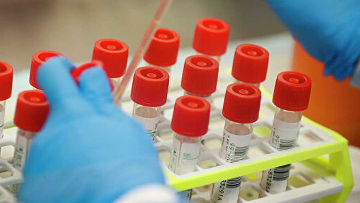 Еще 13 пациентов брянские медики вылечили от коронавируса