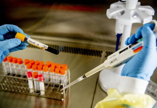 В Брянской области заразились коронавирусной инфекцией 57 человек