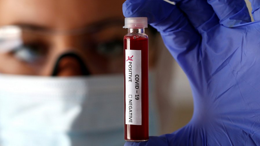 В Брянской области 1367 случаев заражения COVID-19